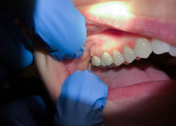 Best After-Hours Dental Trauma Care in Southern Shops, SC